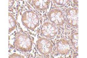Immunohistochemistry of CD248 in human colon tissue with CD248 polyclonal antibody  at 2. (CD248 antibody  (N-Term))