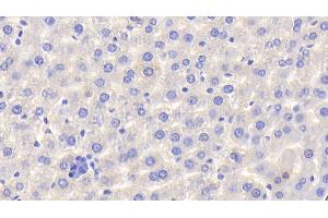 Detection of HPX in Rat Liver Tissue using Polyclonal Antibody to Hemopexin (HPX) (Hemopexin antibody  (AA 31-242))