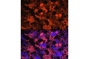 Immunofluorescence analysis of rat bone marrow using CXCL4/PF4 Rabbit pAb (ABIN7269400) at dilution of 1:100 (40x lens). (PF4 antibody)