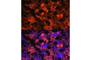 Immunofluorescence analysis of rat bone marrow using CXCL4/PF4 Rabbit pAb (ABIN7269400) at dilution of 1:100 (40x lens).