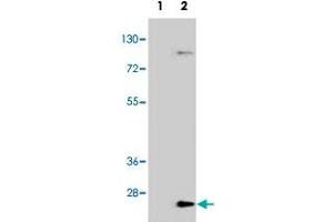 Western blot analysis of UBE2H (arrow) using UBE2H polyclonal antibody .