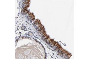 Immunohistochemical staining (Formalin-fixed paraffin-embedded sections) of human nasopharynx shows strong cytoplasmic positivity in respiratory epithelial cells. (CCDC134 antibody)