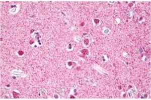 Formalin-Fixed, Paraffin-Embedded Human Brain, Cortex Neurons stained with MSK1 (MSK1 antibody  (Internal Region))