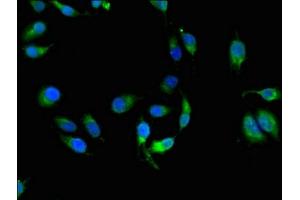Immunofluorescent analysis of Hela cells using ABIN7155625 at dilution of 1:100 (HLA-C antibody  (AA 25-308))