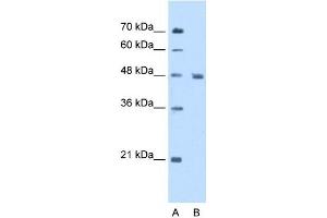 Enolase 3 antibody used at 5 ug/ml to detect target protein. (ENO3 antibody)