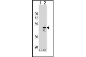 Western blot analysis of OLA1 (arrow) using GTPBP9 / OLA1 Antibody (N-term) Cat. (OLA1 antibody  (N-Term))