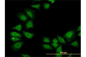 Immunofluorescence of monoclonal antibody to TXN on HeLa cell. (TXN antibody  (AA 1-105))