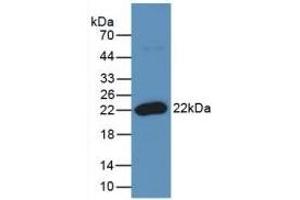 Detection of Recombinant RANkL, Human using Monoclonal Antibody to Receptor Activator Of Nuclear Factor Kappa B Ligand (RANkL) (RANKL antibody  (AA 79-247))