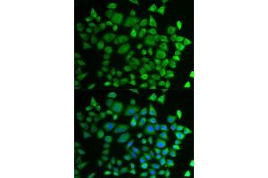 Immunofluorescence analysis of HeLa cells using P4HTM antibody (ABIN6292983). (P4HTM antibody)