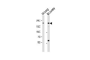 Western blot analysis of lysates from mouse lung, mouse ovary tissue lysate (from left to right), using Erbb2 Antibody  (ABIN6243606 and ABIN6577675). (ErbB2/Her2 antibody  (AA 1142-1176))