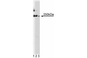 Western blot analysis of LR11 on a rat cerebrum lysate. (SORL1 antibody  (AA 1220-1337))