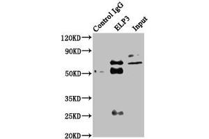 Immunoprecipitating ELP3 in HEK293 whole cell lysate Lane 1: Rabbit control IgG instead of ABIN7151580 in HEK293 whole cell lysate. (ELP3/KAT9 antibody  (AA 1-85))
