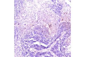 IHC analysis of TANK using anti-TANK antibody (ABIN6719508). (TANK antibody)