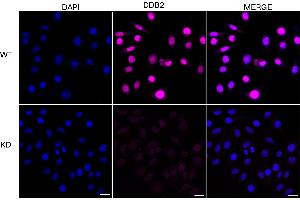 Immunocytochemical staining of HeLa cells using DDB2 antibody (ABIN7798274), 1:1,000), Top panel: wild-type (WT), Bottom panal: DDB2 shRNA knockdown (KD). (Recombinant DDB2 antibody)