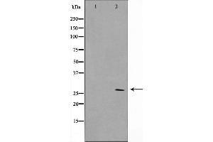 Western blot analysis on HuvEc cell lysate using SIX6 Antibody，The lane on the left is treated with the antigen-specific peptide. (SIX Homeobox 6 antibody  (Internal Region))