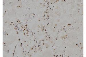 ABIN6277000 at 1/100 staining Human lung tissue by IHC-P. (PSMC3 antibody)