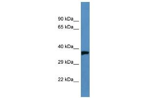 Western Blotting (WB) image for anti-Opsin 1 (Cone Pigments), Medium-Wave-Sensitive (OPN1MW) (C-Term) antibody (ABIN2788201) (OPN1MW antibody  (C-Term))