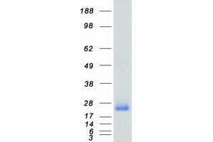 Validation with Western Blot (RHOA Protein (Myc-DYKDDDDK Tag))