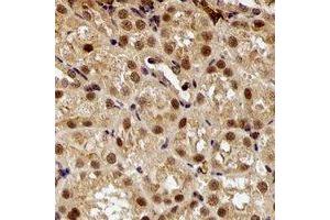 Immunohistochemical analysis of E6AP staining in rat kidney formalin fixed paraffin embedded tissue section. (ube3a antibody)