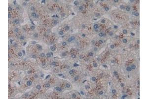 Detection of CD301 in Human Liver Tissue using Polyclonal Antibody to Cluster Of differentiation 301 (CD301) (CLEC10A antibody  (AA 71-239))