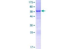 Image no. 1 for Hepatoma Derived Growth Factor-Like 1 (HDGFL1) (AA 1-251) protein (GST tag) (ABIN1306480) (HDGFL1 Protein (AA 1-251) (GST tag))
