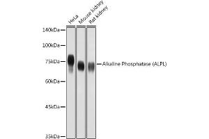 Western blot analysis of extracts of various cell lines, using Alkaline Phosphatase (ALPL) antibody (ABIN3021385, ABIN3021386, ABIN1512569 and ABIN6214987) at 1:1000 dilution. (ALPL antibody  (AA 20-270))