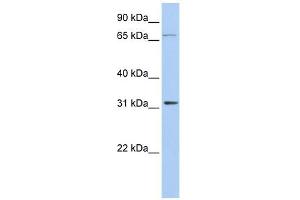 IDI1 antibody used at 1 ug/ml to detect target protein. (IDI1 antibody  (Middle Region))