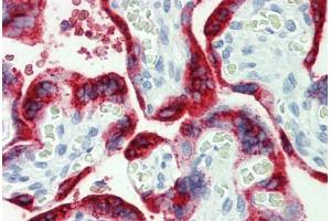 Human Placenta: Formalin-Fixed, Paraffin-Embedded (FFPE) (Growth Hormone 1 antibody  (AA 1-217))
