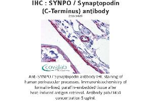 Image no. 2 for anti-Synaptopodin (SYNPO) (C-Term) antibody (ABIN1739830) (SYNPO antibody  (C-Term))