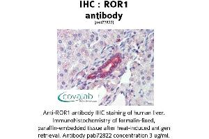 Image no. 2 for anti-Receptor Tyrosine Kinase-Like Orphan Receptor 1 (ROR1) (C-Term) antibody (ABIN1738934) (ROR1 antibody  (C-Term))