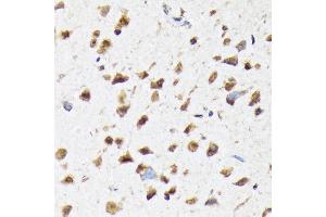 Immunohistochemistry (IHC) image for anti-Eukaryotic Translation Initiation Factor 2B, Subunit 5 Epsilon, 82kDa (EIF2B5) antibody (ABIN7267038)
