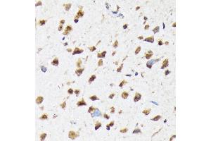 Immunohistochemistry of paraffin-embedded rat brain using eIF2B epsilon (EIF2B5) (EIF2B5) Rabbit mAb (ABIN7267038) at dilution of 1:100 (40x lens). (EIF2B5 antibody)