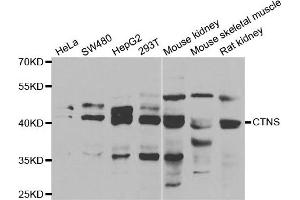 Western blot analysis of extracts of various cell lines, using CTNS antibody. (CTNS antibody)