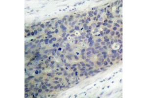 Immunohistochemistry (IHC) image for anti-LIM Domain Kinase 2 (LIMK2) (pThr505) antibody (ABIN3020313) (LIMK2 antibody  (pThr505))