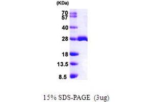 SDS-PAGE (SDS) image for MOB1, Mps One Binder Kinase Activator-Like 1B (MOBKL1B) (AA 1-216) protein (His tag) (ABIN667320) (MOB1A Protein (AA 1-216) (His tag))