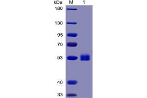 Human IL6 Protein, mFc-His Tag on SDS-PAGE under reducing condition. (IL-6 Protein (mFc-His Tag))