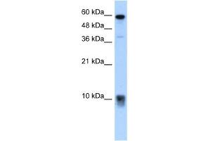 WB Suggested Anti-S100A3 Antibody Titration:  5. (S100A3 antibody  (N-Term))