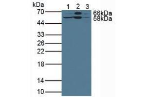 Western blot analysis of (1) Rat Liver Tissue, (2) Mouse Liver Tissue and (3) Human HepG2 Cells. (LSR antibody  (AA 35-205))