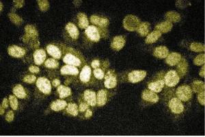 Immunofluorescent staining of HeLa cells. (RIPK2 antibody  (AA 333-532))