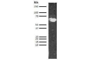 Western Blotting (WB) image for anti-Low Molecular Weight Kininogen (LMWK) antibody (Biotin) (ABIN613239) (LMW Kininogen antibody  (Biotin))