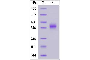 SDS-PAGE (SDS) image for Natural Cytotoxicity Triggering Receptor 1 (NCR1) (AA 22-257) (Active) protein (His tag,AVI tag,Biotin) (ABIN6973180)