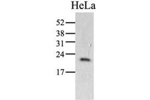 The HeLa (40ug) were resolved by SDS-PAGE, transferred to PVDF membrane and probed with anti-human PPIC antibody (1:1000). (PPIC antibody)