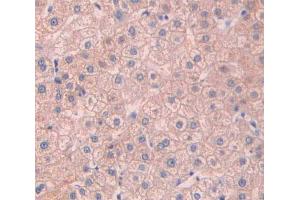 Used in DAB staining on fromalin fixed paraffin- embedded liver tissue (Asialoglycoprotein Receptor 2 antibody  (AA 1-311))
