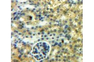 IHC-P analysis of Kidney tissue, with DAB staining. (SFRP1 antibody  (AA 32-314))