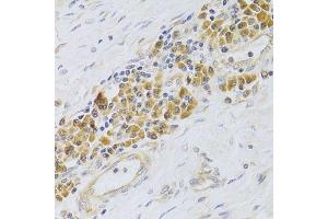 Immunohistochemistry (Paraffin-embedded Sections) (IHC (p)) image for anti-Proliferation-Associated 2G4, 38kDa (PA2G4) (AA 1-394) antibody (ABIN6145146)