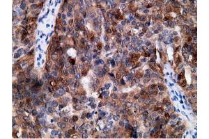 Immunohistochemical staining of paraffin-embedded Human colon tissue using anti-EPHX2 mouse monoclonal antibody.