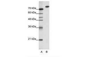 Image no. 1 for anti-Kelch-Like 3 (KLHL3) (N-Term) antibody (ABIN202791) (KLHL3 antibody  (N-Term))