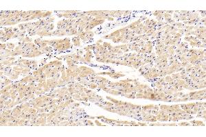 Detection of TNKS2 in Human Cardiac Muscle Tissue using Polyclonal Antibody to Tankyrase 2 (TNKS2) (TNKS2 antibody)