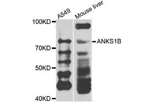 Western blot analysis of extracts of A549 and mouse liver cells, using ANKS1B antibody. (ANKS1B antibody)
