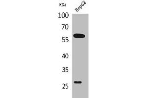 Western Blot analysis of HepG2 cells using GGT1 Polyclonal Antibody (GGT1 antibody  (N-Term))